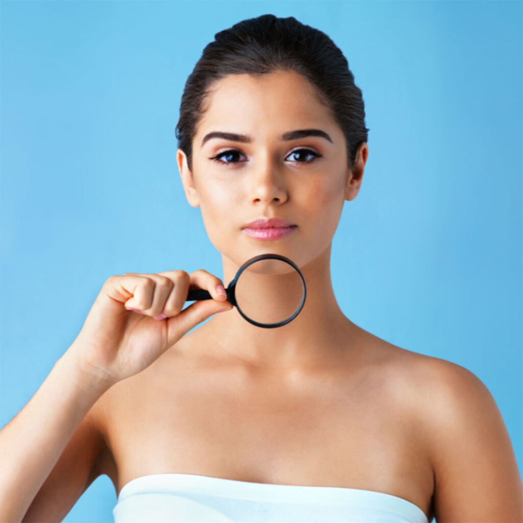 PCOS